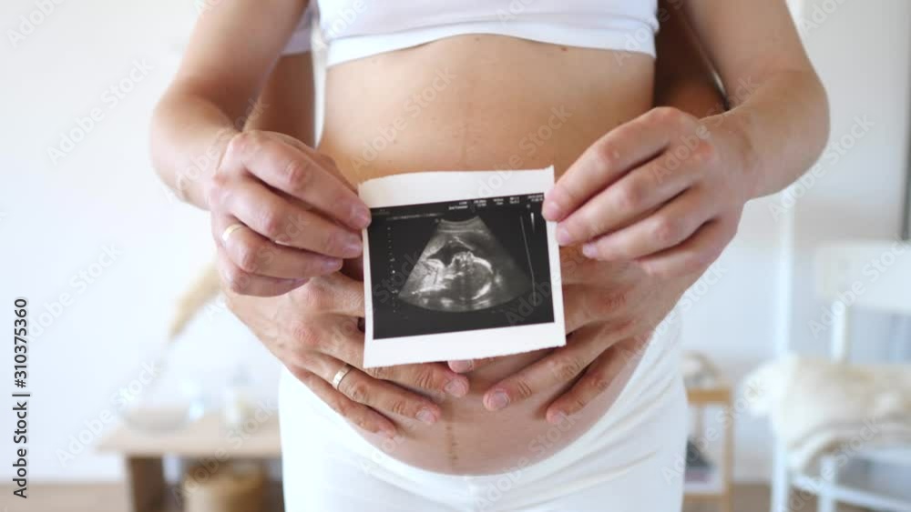 Man And Pregnant Woman Holding Ultrasound Photo On Belly. Man And Pregnant Woman Holding Ultrasound Photo On Belly.