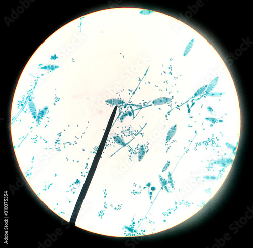 Close up macro conidia of fungi. photo