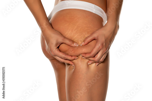woman squeezing the cellulite on her butt on white background