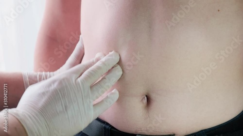 Doctor performs palpation of the abdominal organs of the patient, close-up photo