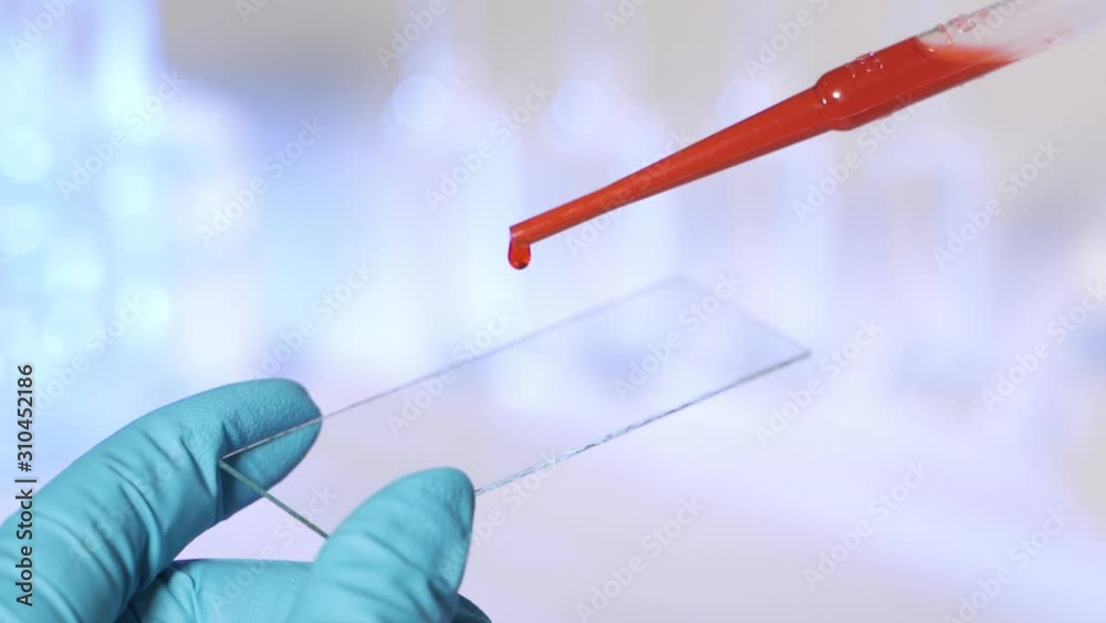 Woman laboratory technician applying drops of blood on glass slide from pipette in lab in slow motion Woman laboratory technician applying drops of blood on glass slide from pipette in lab in slow motion