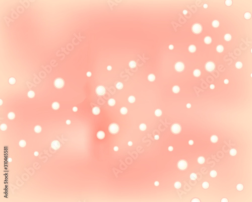 Miliums, closed comedones, Skin with acne background. Black spots. Acne on the skin texture. Infographics. Vector illustration.