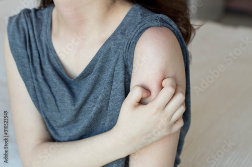 Wallpaper Mural Girl scratch the itch with hand, Arm, Itching, Concept with Healthcare And Medicine. Torontodigital.ca