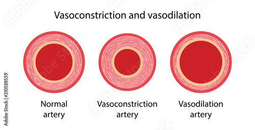 Arterial vasoconstriction and vasodilation. Comparison illustration of normal, constricted, and dilated blood vessels. Diagram of cross section of arteries. Vector illustration photo