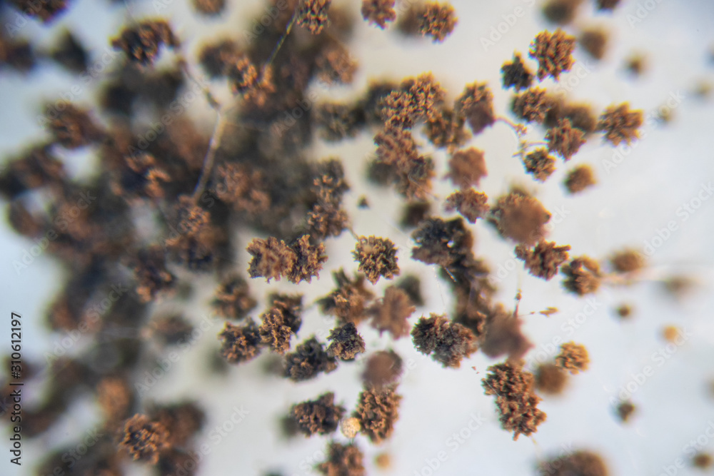 Backgrounds Colony Characteristics of Rhizopus (bread mold) is a genus of common saprophytic fungi, Rhizopus (bread mold) under the microscope. Backgrounds Colony Characteristics of Rhizopus (bread mold) is a genus of common saprophytic fungi, Rhizopus (bread mold) under the microscope.