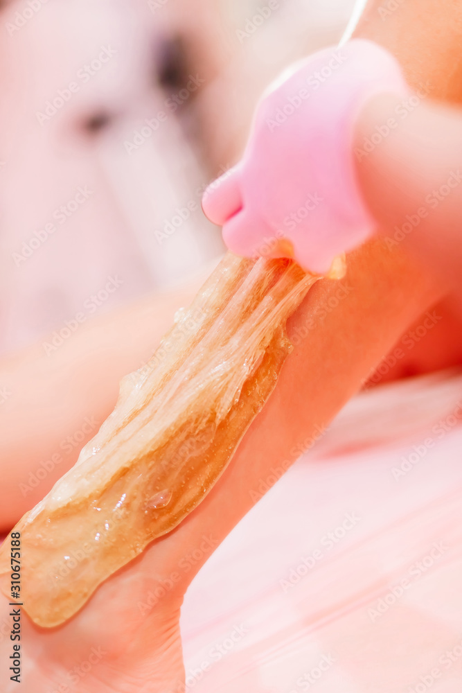 Close-up hands of cosmetologist in rose gloves applying paste for sugaring depilation. A master makes removing unnecessary hair on the legs. Procedure removal in a beauty salon. Depilatory sugar paste Close-up hands of cosmetologist in rose gloves applying paste for sugaring depilation. A master makes removing unnecessary hair on the legs. Procedure removal in a beauty salon. Depilatory sugar paste
