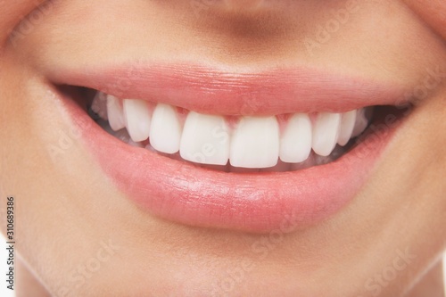 Fototapeta Woman Smiling With Prefect White Teeth