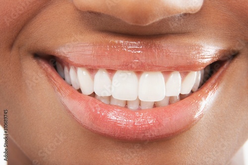 Woman With Perfect White Teeth