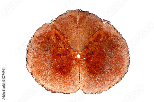 Cross section of spinal cord under the microscope view.