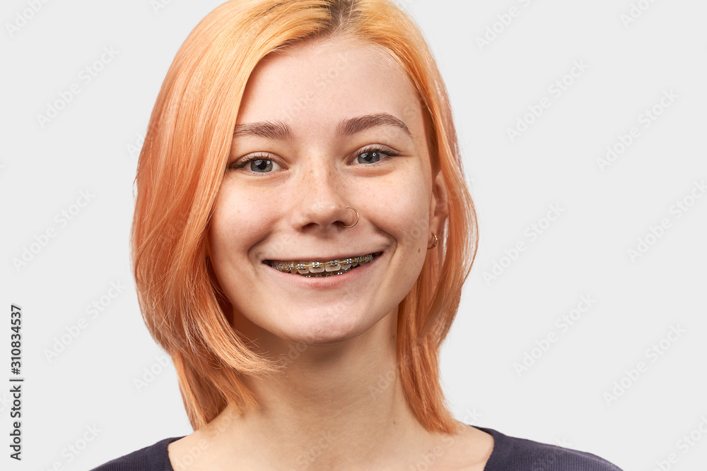 Cheerful girl with green eyes with earring in nose and braces on teeth, enjoys smooth teeth, has beautiful smile, isolated on white background. Close-up shot of young woman after visit to dentist Cheerful girl with green eyes with earring in nose and braces on teeth, enjoys smooth teeth, has beautiful smile, isolated on white background. Close-up shot of young woman after visit to dentist