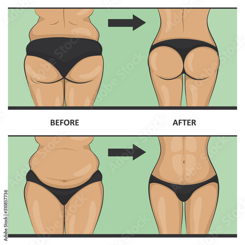 Thick and thin, overweight problems concept.