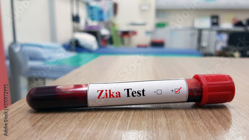 Positive Zika test and laboratory sample of blood testing for diagnosis Zika virus infection with blurred hospital background. Tropical infectious disease and Diagnostic technology concept.