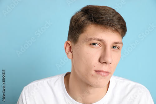 Teen guy with acne problem on light blue background