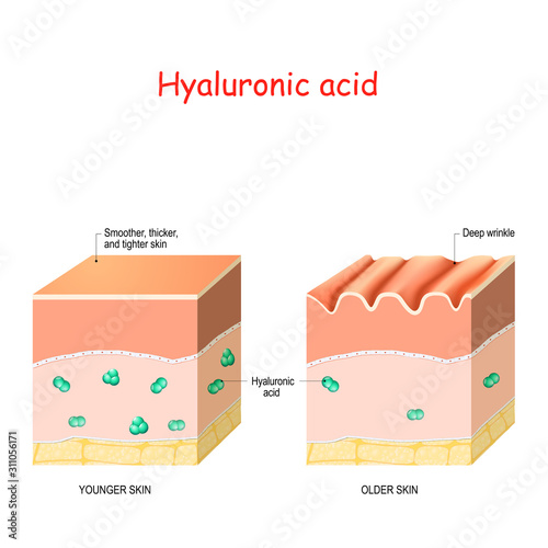 Hyaluronic acid in younger and older skin