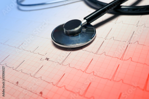 Vászonkép Stethoscope on the heart cardiogram