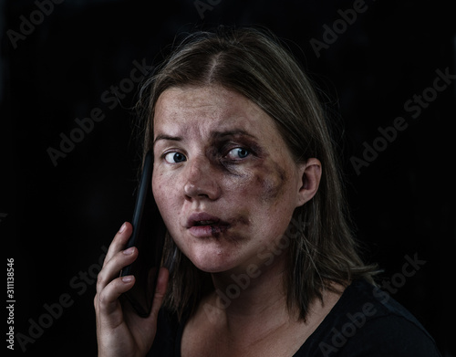 Woman victim of domestic violence and abuse asks for help by phone. Isolated on dark background