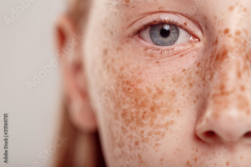 Inclusive Beauty. Girl with freckles standing isolated on grey looking camera concentrated eye close-up close-up