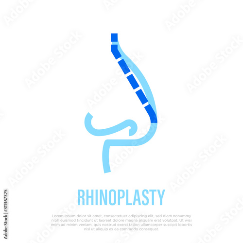 Rhinoplasty thin line icon. Nasal correction by plastic surgery. Vector illustration.