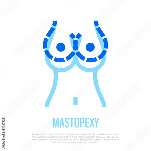 Mastopexy thin line icon. Breast size correction. Plastic surgery. Vector illustration.