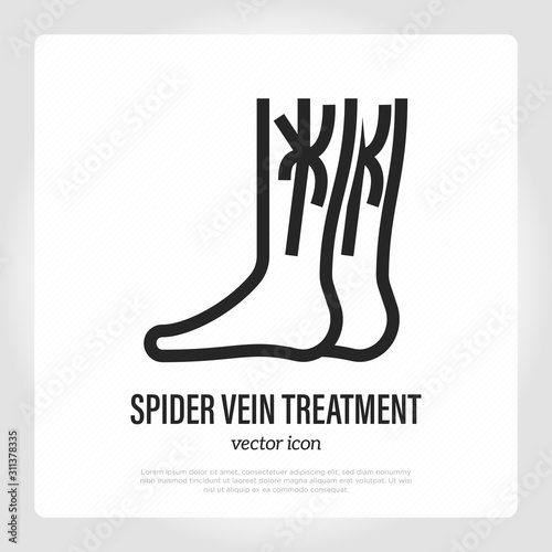 Varicose vein treatment thin line icon. Plastic surgery. Vector illustration.