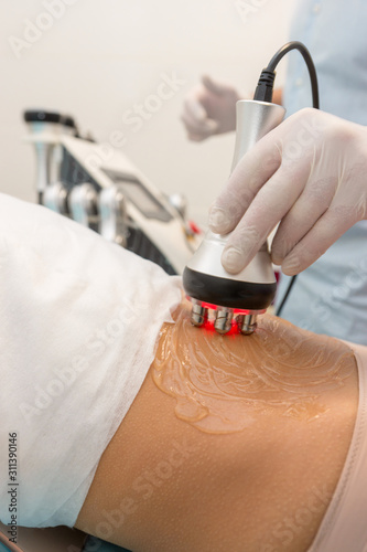 Radio frequency skin tightening, belly. Female body, cosmetology procedure.