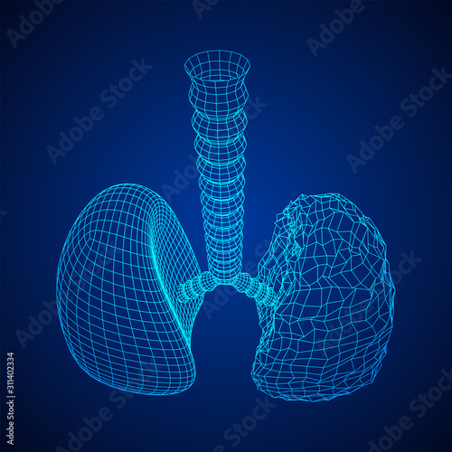 Healthy and sick lung with trachea bronchi internal organ human. Pulmonology medicine science technology concept. Wireframe low poly mesh vector illustration
