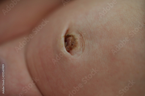 navel of newborn baby, closeup image photo