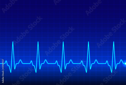 ECG heartbeat monitor, cardiogram heart pulse line wave. Electrocardiogram medical background