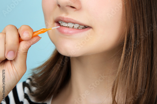 Young girl with dental braces holding toothbrush on blue background