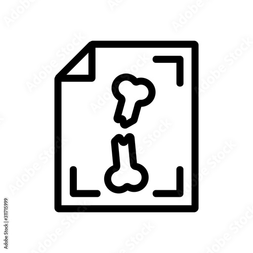 X-ray fracture icon vector. A thin line sign. Isolated contour symbol illustration