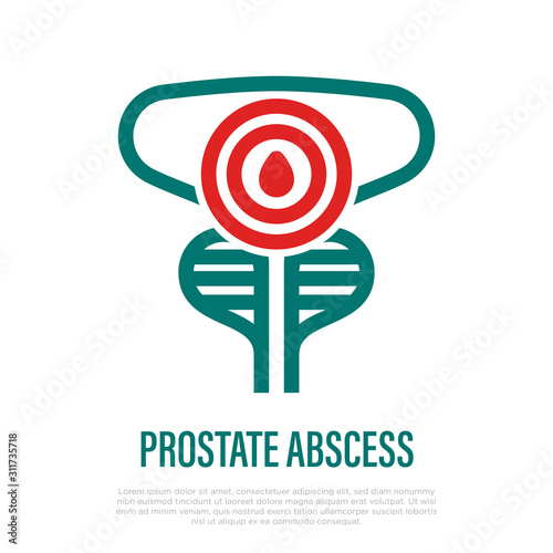 Prostate abscess thin line icon. Acute pain and inflammation. Bacterial prostatitis. Vector illustration.