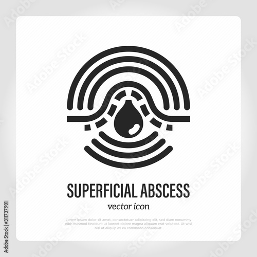 Superficial abscess thin line icon. Pus under skin, inflammation and pain. Furuncle, pustule, acne. Vector illustration.