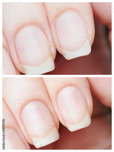macro nail clear manicure and clean cuticle before and after