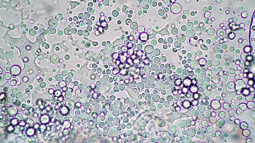 Bright microcosm of lactobacilli under the microscope. Microcosmic background. Theme of lactic acid foods is under 1000x magnification. Bacteria from an edible milk product such as kefir or yogurt. photo