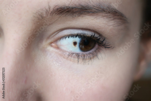 Eyeball freckle, freckle in the eye, detail of woman face.