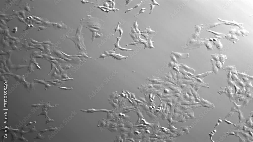 Movement, growth, and division of cancer cells in culture