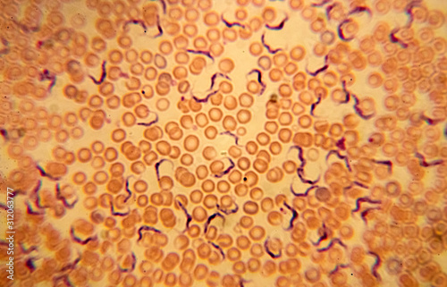 Trypanosoma vittatae Robertson, 1909 among red blood cells (turtle blood smear) - permanent microscope slide