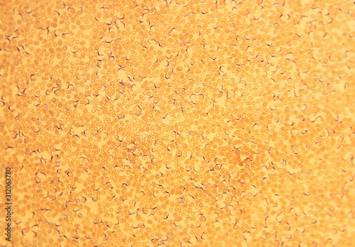Trypanosoma vittatae Robertson, 1909 among red blood cells (turtle blood smear) - permanent microscope slide photo