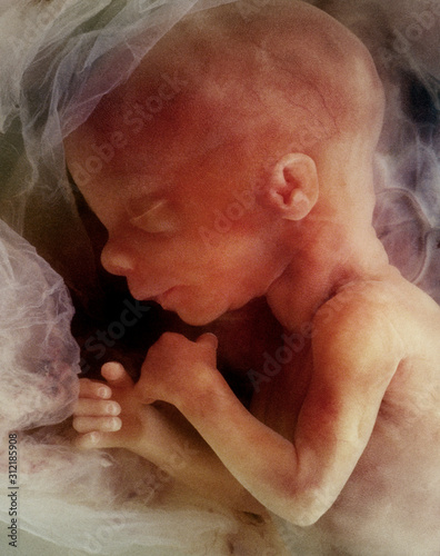 Photo In-vitro image of a human fetus