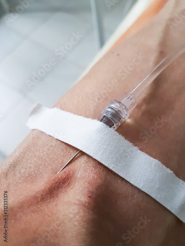 Medical dropper supplies the medicine through a needle directly into the vein of a person in the hospital