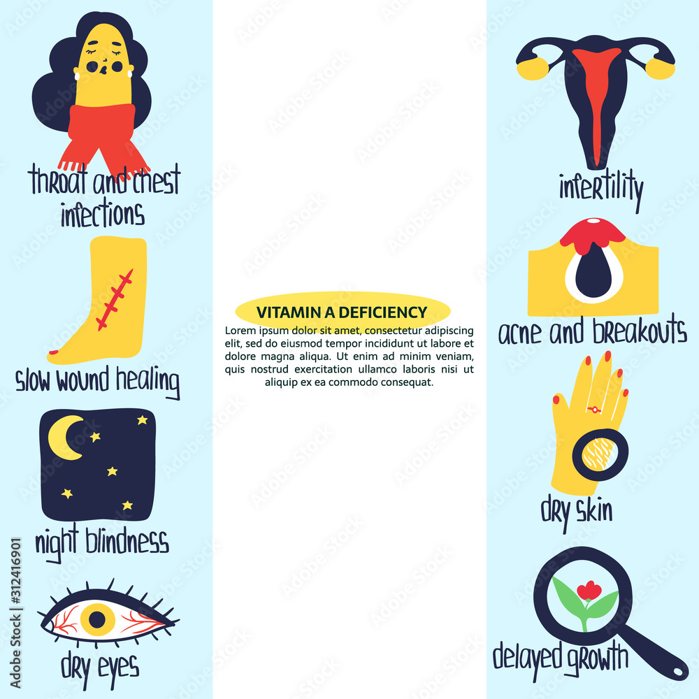 Hand drawn vitamin A or retinol deficiency dry skin, night blindness