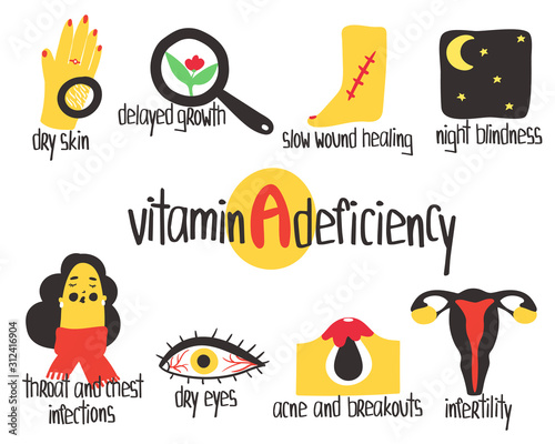 Hand drawn vitamin A or retinol deficiency: dry skin, night blindness, dry eyes, infertility, delayed growth. Vector illustration is for pharmacological or medical poster, brochure.