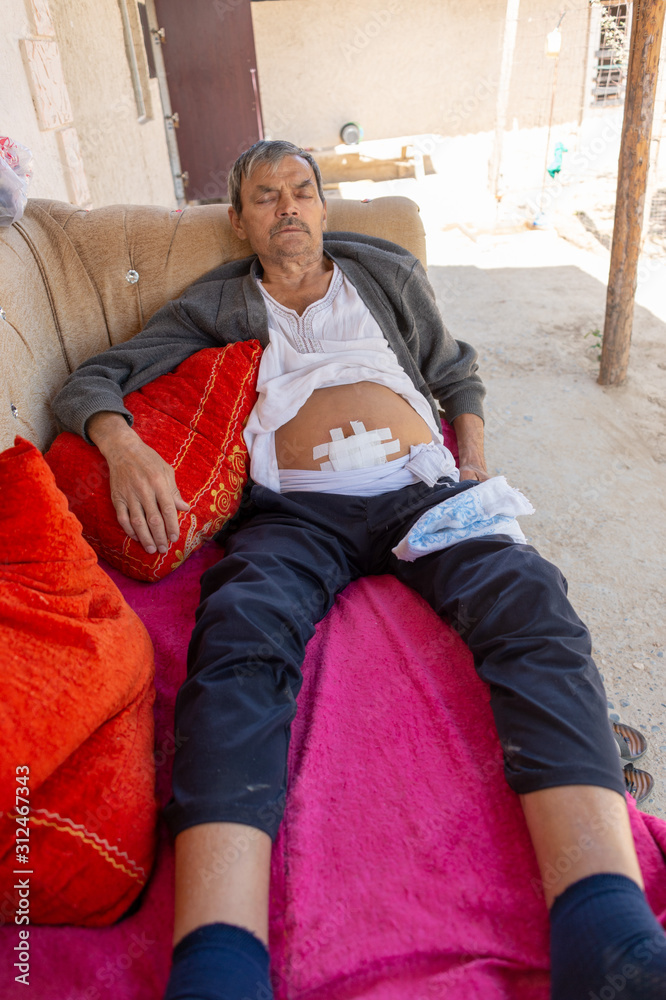 ascitic disease - ascites in humans, and he sits on a soft sofa and thinks how to be treated ascitic disease - ascites in humans, and he sits on a soft sofa and thinks how to be treated