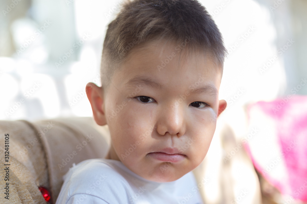 Good morning. Cute boy woke up with a swollen face Good morning. Cute boy woke up with a swollen face