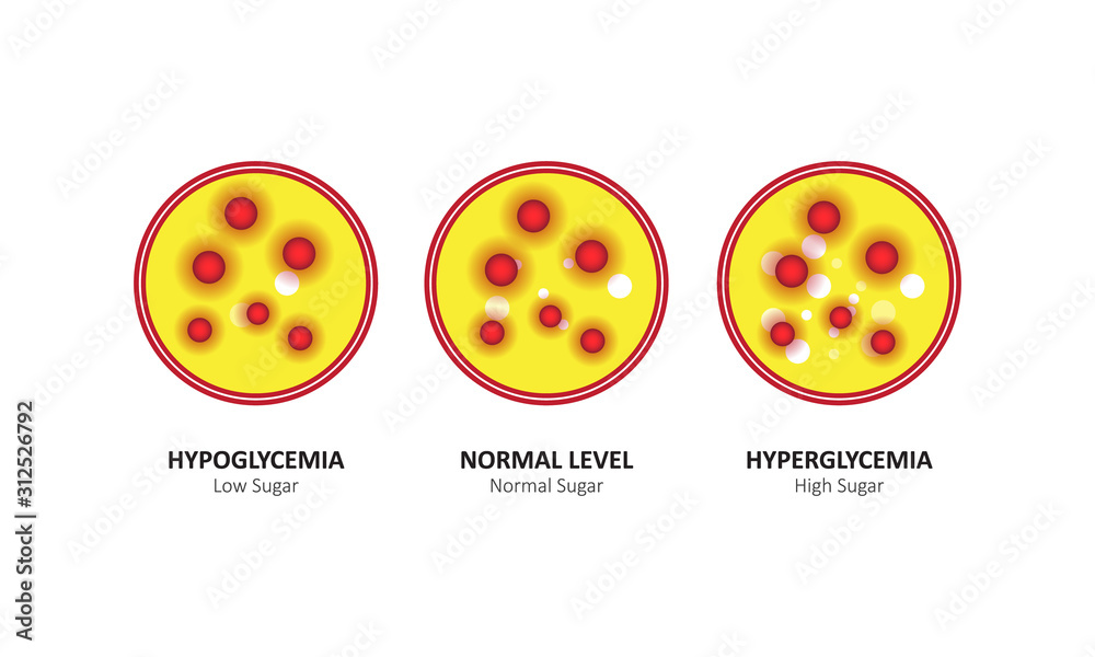 Glucose blood level sugar test. vector illustration Stock Vector ...