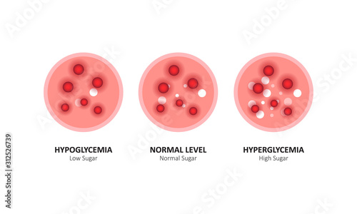 Glucose blood level sugar test. vector illustration
