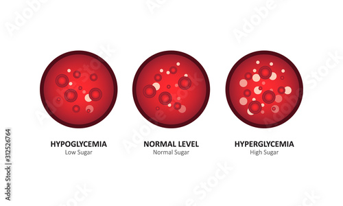 Glucose blood level sugar test. vector illustration