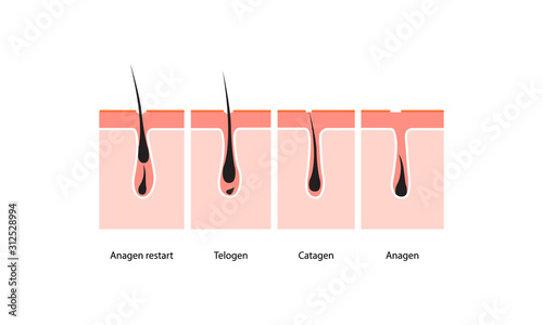 Hair growth cycle skin. vector illustration
