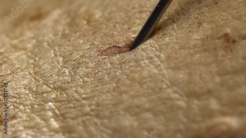 Macro hypodermic needle plunging into skin close up with some blood droplets like drugs heroin addiction or medical photo