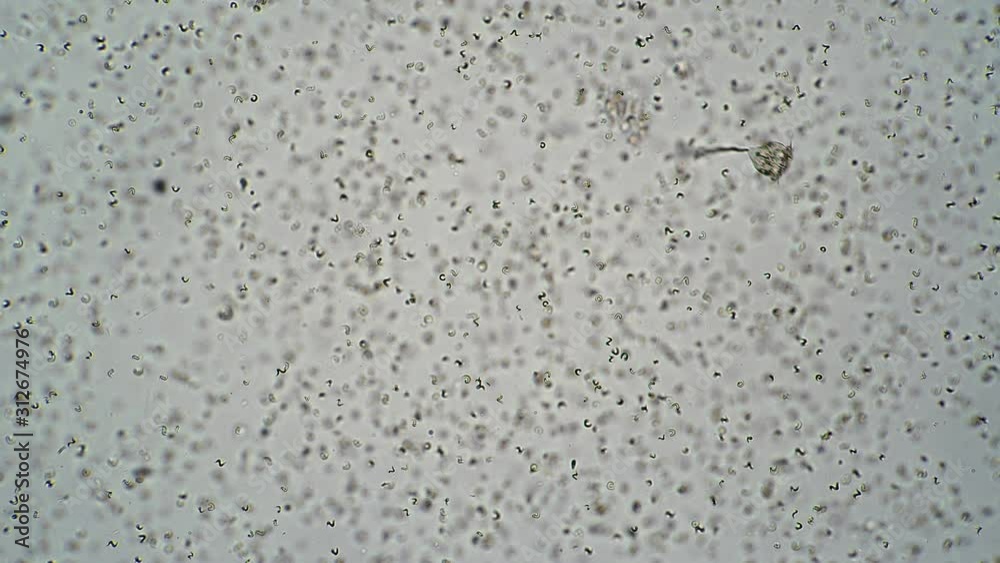 Ciliate vorticella vagabond whirling waving stem. Theme of laboratory biological research under microscope. Microscopic protozoa in a drop of water under magnification. Microcosm close-up. Ciliate vorticella vagabond whirling waving stem. Theme of laboratory biological research under microscope. Microscopic protozoa in a drop of water under magnification. Microcosm close-up.